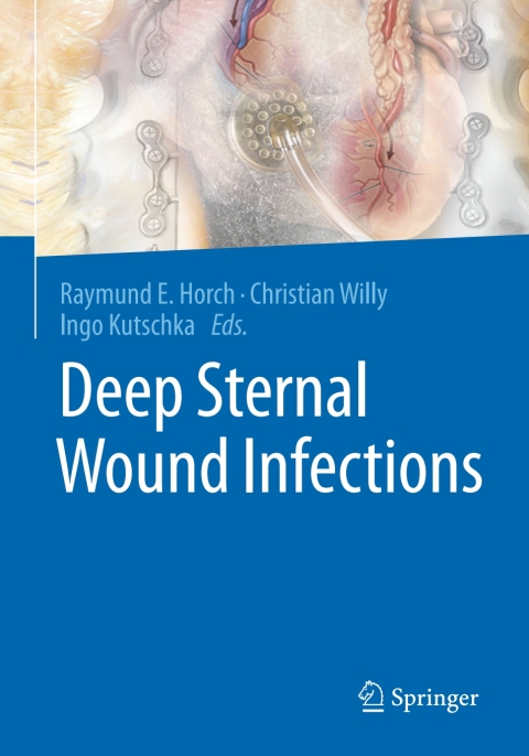 Cover image for book Deep Sternal Wound Infections