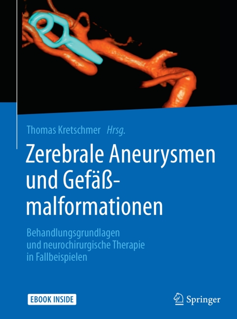 Cover image for book Zerebrale Aneurysmen und Gefäßmalformationen