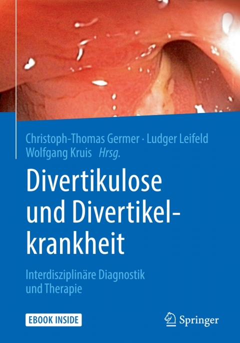 Cover image for book Divertikulose und Divertikelkrankheit