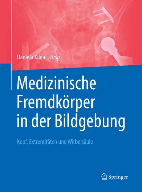 Cover image for book Medizinische Fremdkörper in der Bildgebung