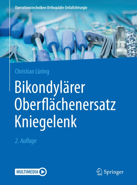 Cover image for book Bikondylärer Oberflächenersatz Kniegelenk