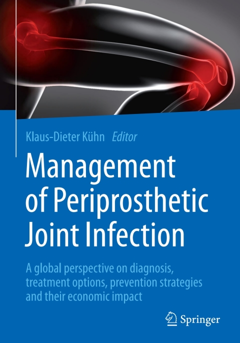 Cover image for book Management of Periprosthetic Joint Infection