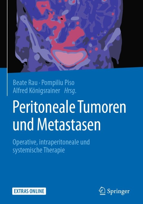 Cover image for book Peritoneale Tumoren und Metastasen