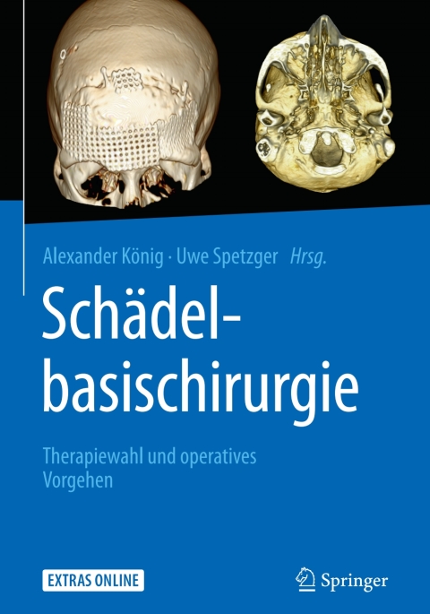 Cover image for book Schädelbasischirurgie