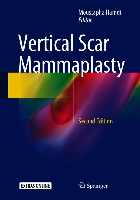 Cover image for book Vertical Scar Mammaplasty