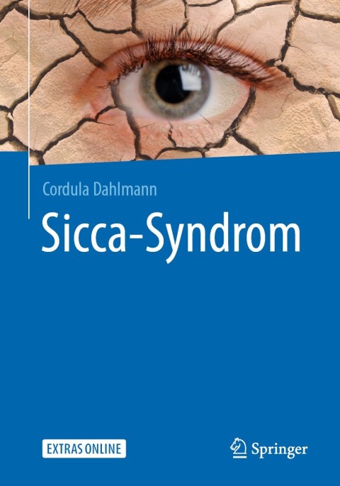 Cover image for book Sicca-Syndrom