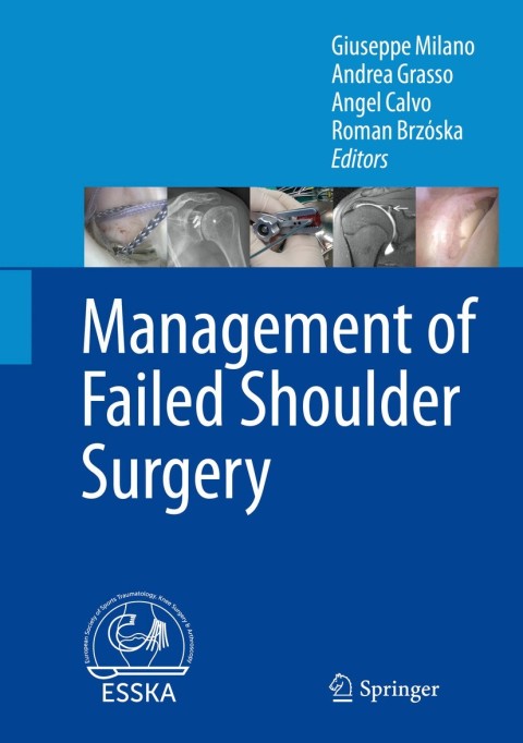 Cover image for book Management of Failed Shoulder Surgery