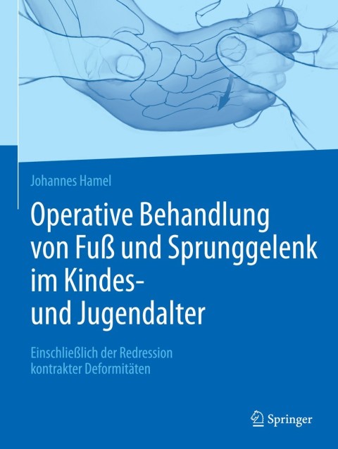 Cover image for book Operative Behandlung von Fuß und Sprunggelenk im Kindes- und Jugendalter