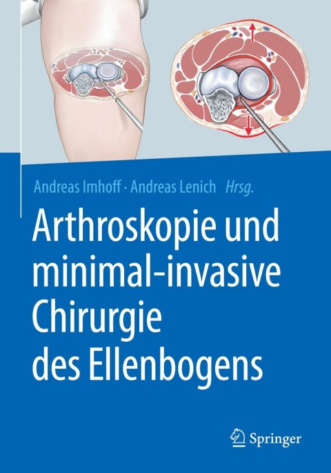 Cover image for book Arthroskopie und minimal-invasive Chirurgie des Ellenbogens