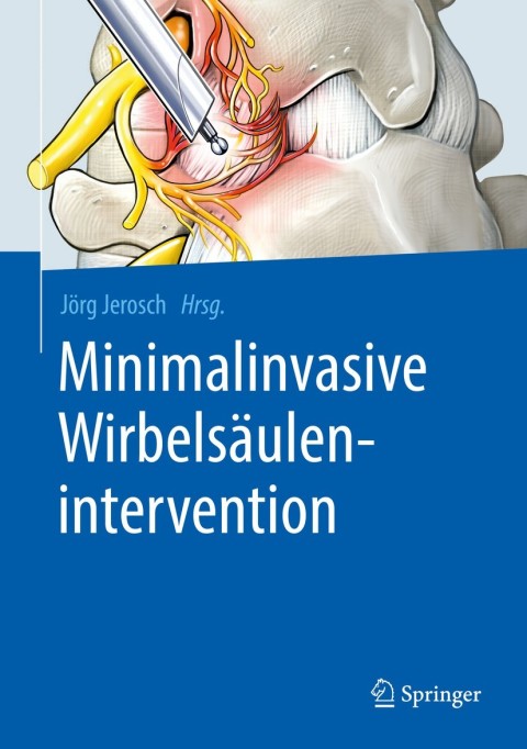 Cover image for book Minimalinvasive Wirbelsäulenintervention
