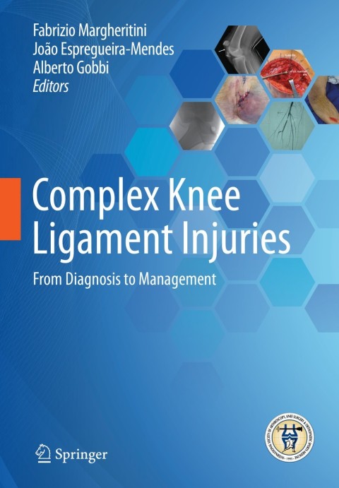 Cover image for book Complex Knee Ligament Injuries