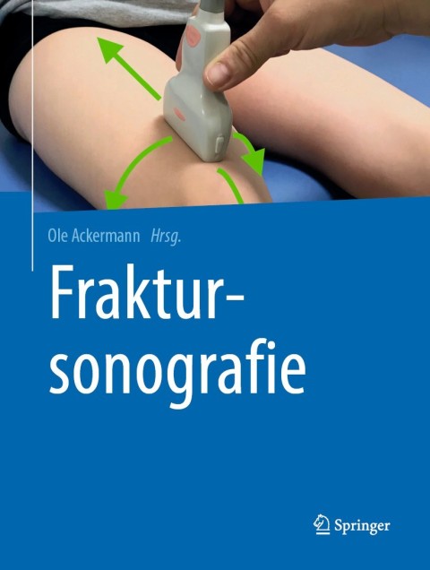 Cover image for book Fraktursonografie