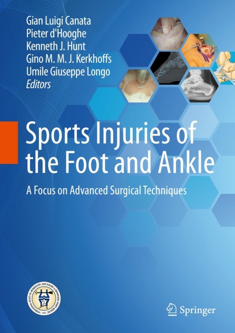 Cover image for book Sports Injuries of the Foot and Ankle