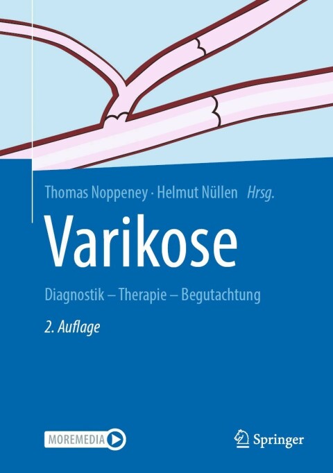 Cover image for book Varikose