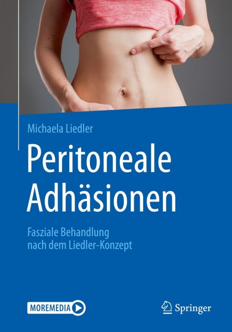 Cover image for book Peritoneale Adhäsionen