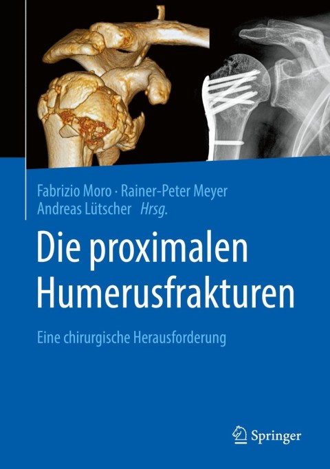 Cover image for book Die proximalen Humerusfrakturen