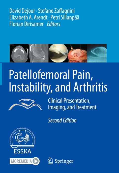 Cover image for book Patellofemoral Pain, Instability, and Arthritis