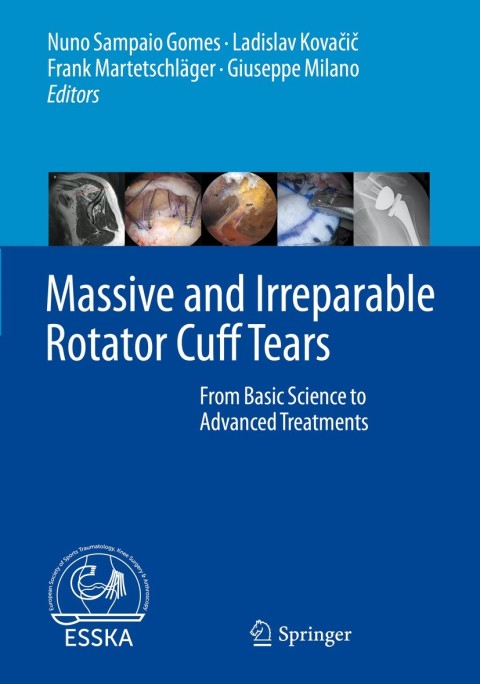 Cover image for book Massive and Irreparable Rotator Cuff Tears