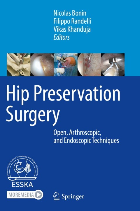 Cover image for book Hip Preservation Surgery