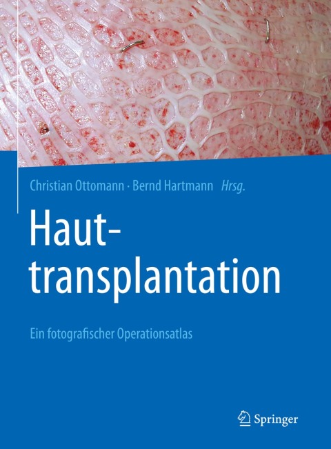 Cover image for book Hauttransplantation