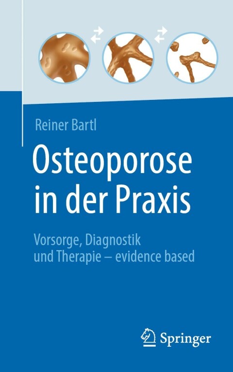Osteoporose in der Praxis 