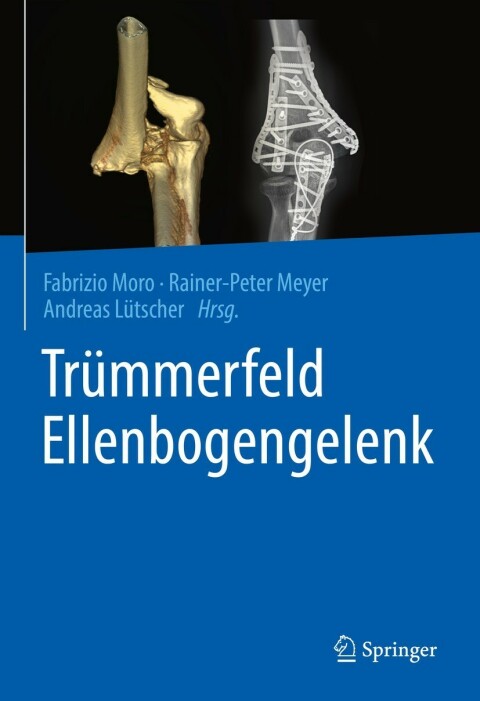 Cover image for book Trümmerfeld Ellenbogengelenk