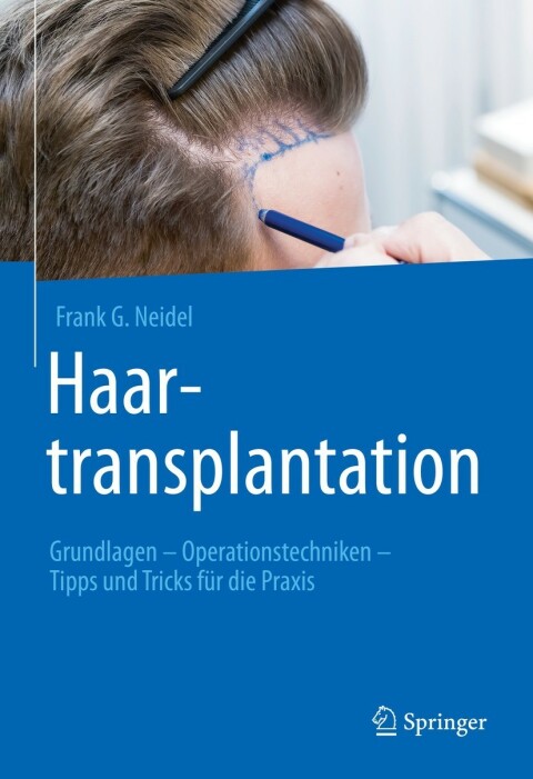 Cover image for book Haartransplantation