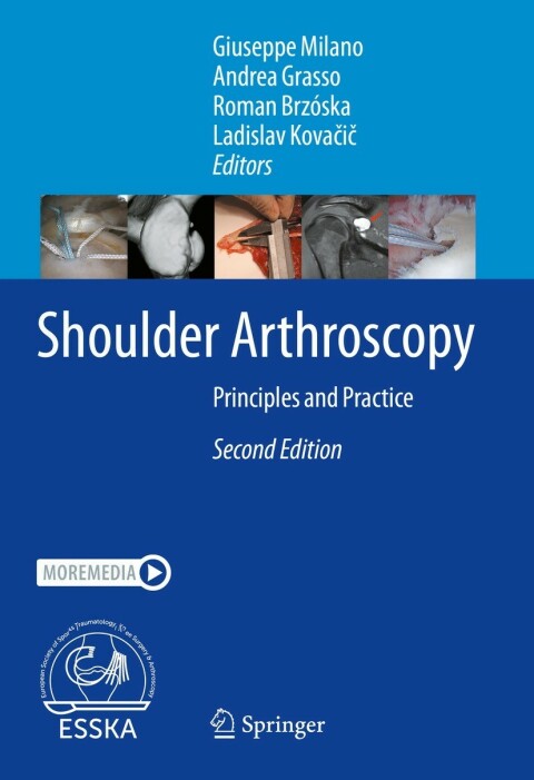 Cover image for book Shoulder Arthroscopy