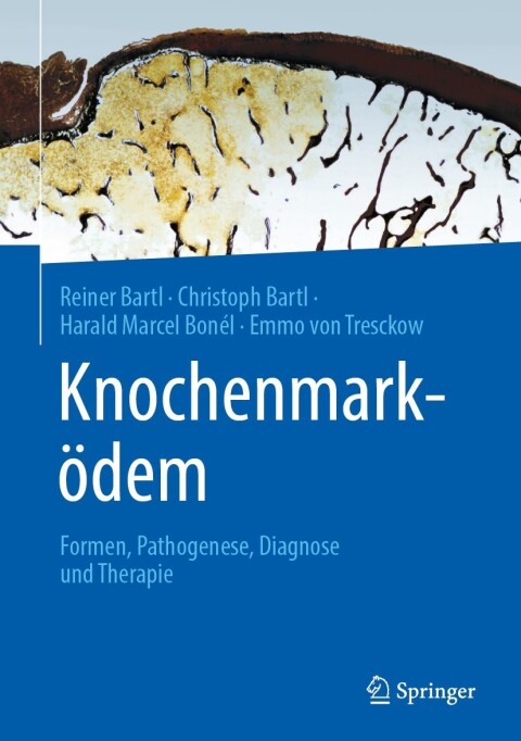 Knochenmarködem 