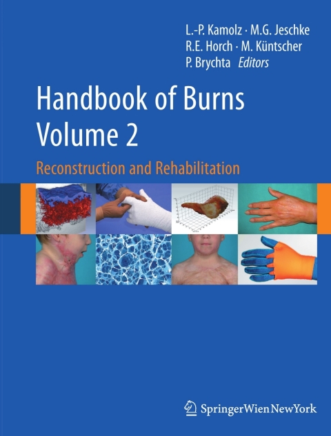 Cover image for book Handbook of Burns Volume 2