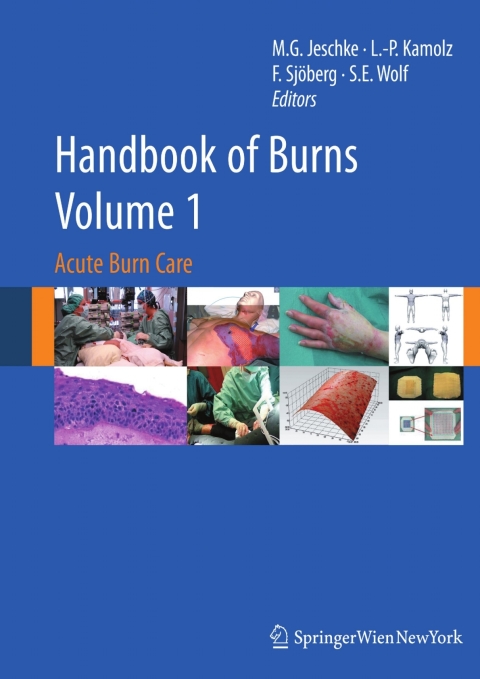 Cover image for book Handbook of Burns Volume 1