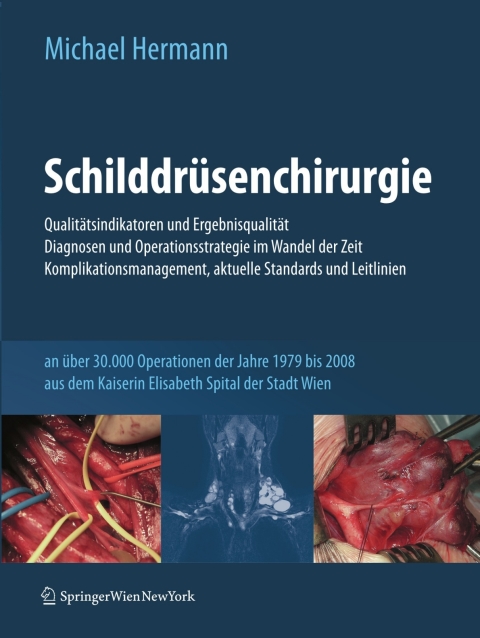 Cover image for book Schilddrüsenchirurgie - Qualitätsindikatoren und Ergebnisqualität, Diagnosen und Operationsstrategie im Wandel der Zeit, Komplikationsmanagement, aktuelle Standards und Leitlinien