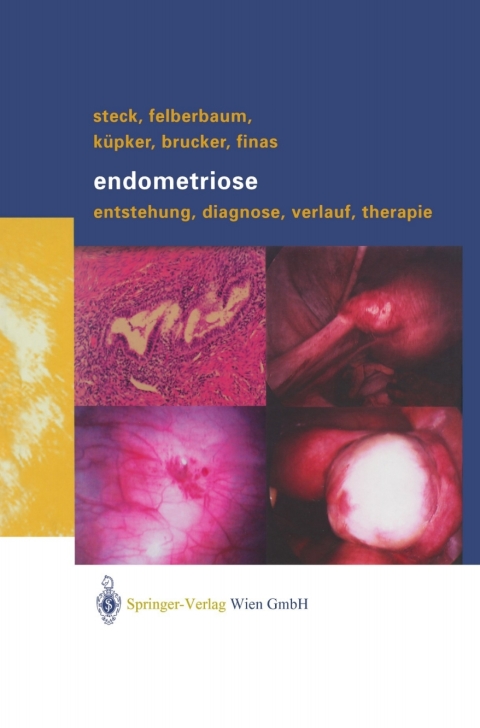 Cover image for book Endometriose