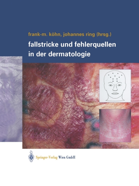 Cover image for book Fallstricke und Fehlerquellen in der Dermatologie