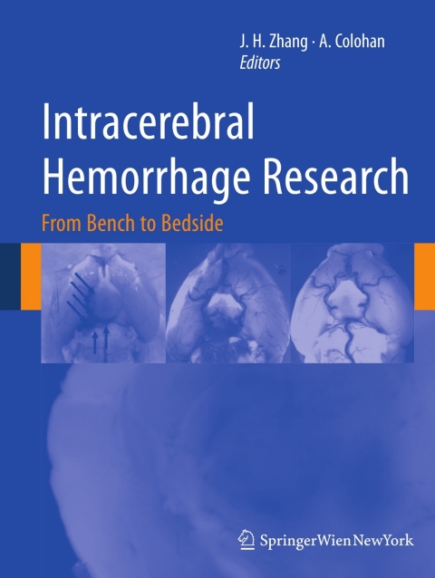 Cover image for book Intracerebral Hemorrhage Research