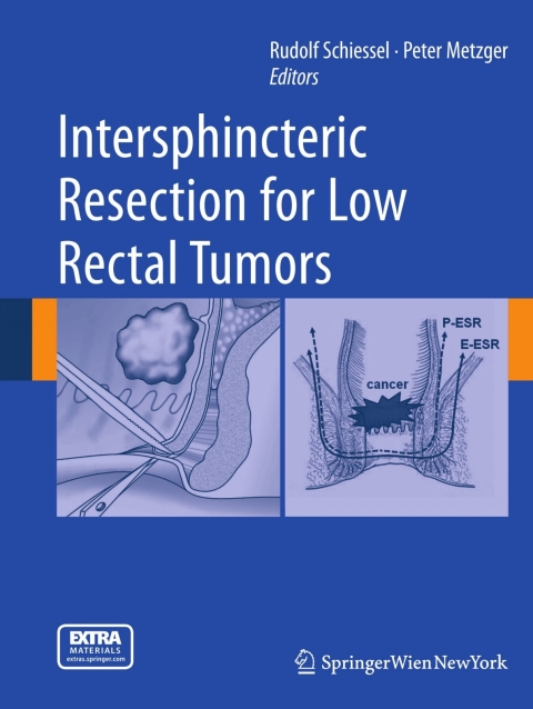 Cover image for book Intersphincteric Resection for Low Rectal Tumors
