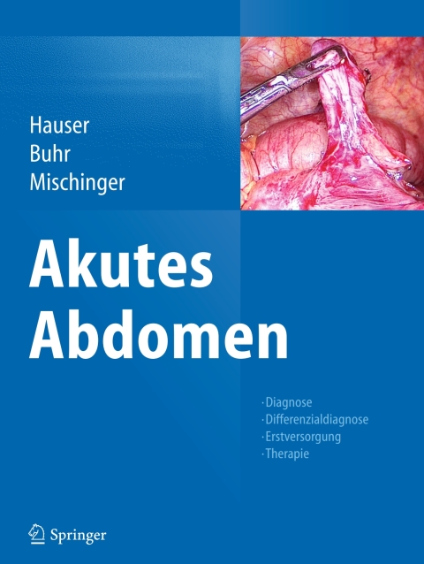Cover image for book Akutes Abdomen