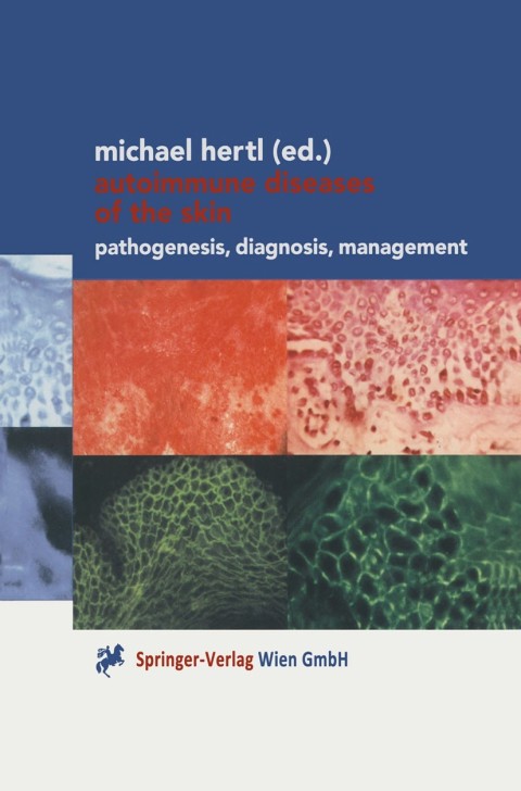 Cover image for book Autoimmune Diseases of the Skin