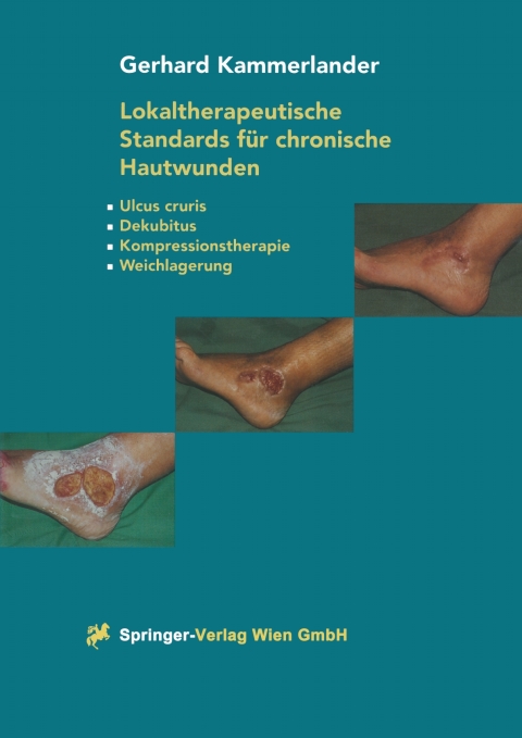 Cover image for book Lokaltherapeutische Standards für chronische Hautwunden