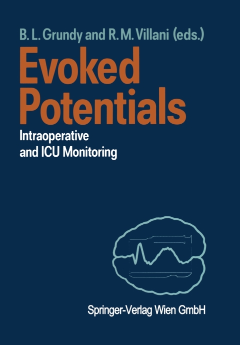 Cover image for book Evoked Potentials