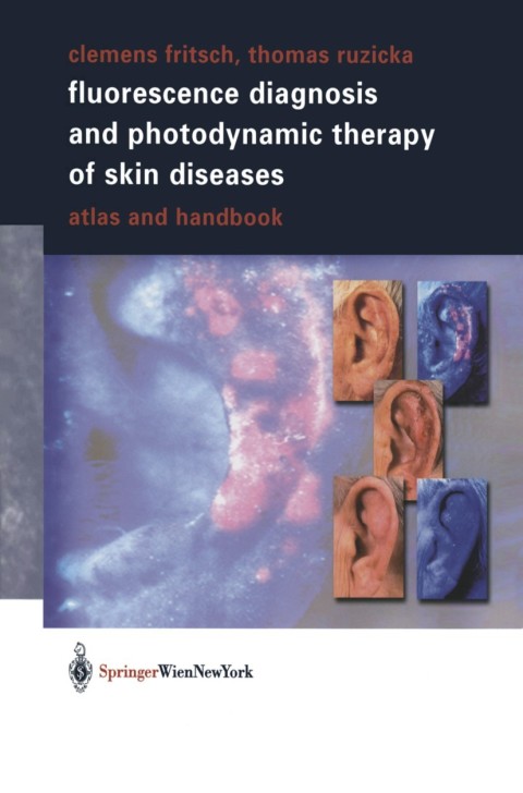 Cover image for book Fluorescence Diagnosis and Photodynamic Therapy of Skin Diseases