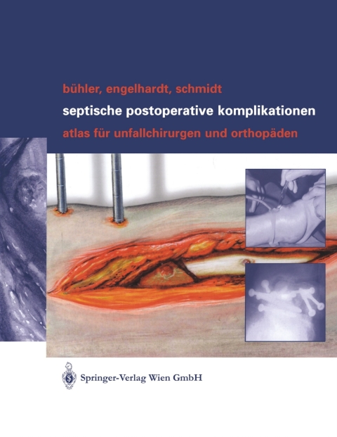 Cover image for book Septische postoperative Komplikationen