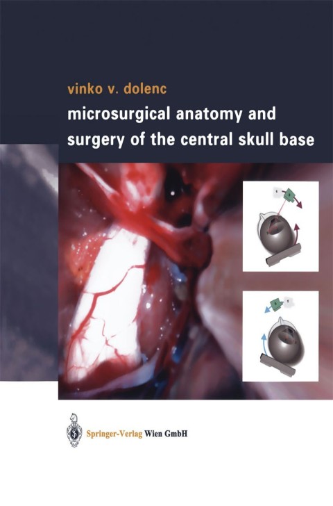 Cover image for book Microsurgical Anatomy and Surgery of the Central Skull Base