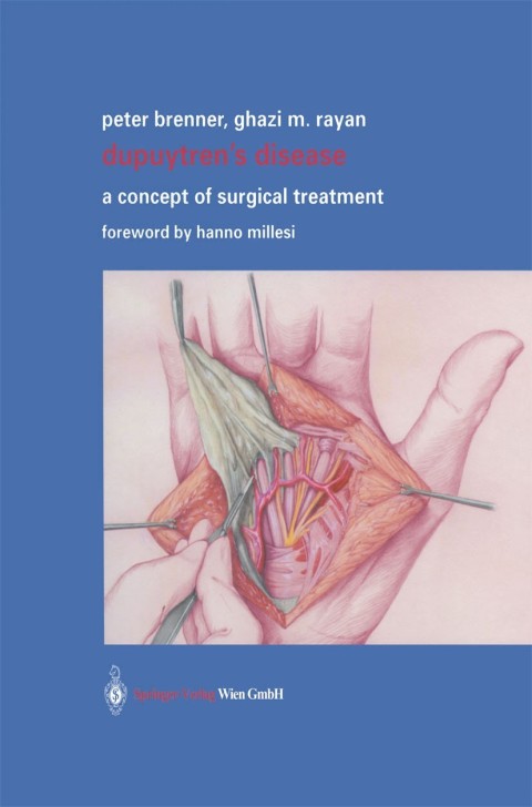Cover image for book Dupuytren’s Disease