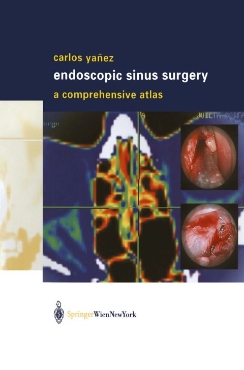 Cover image for book Endoscopic Sinus Surgery