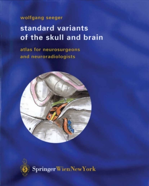 Cover image for book Standard Variants of the Skull and Brain