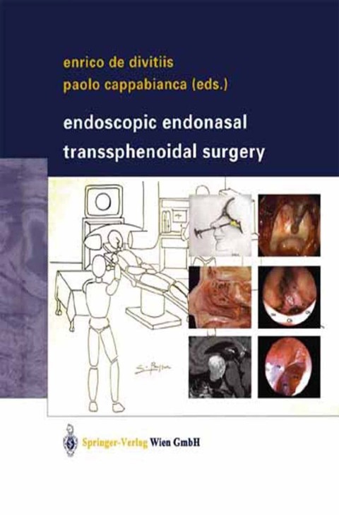 Cover image for book Endoscopic Endonasal Transsphenoidal Surgery