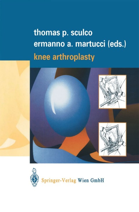 Cover image for book Knee Arthroplasty