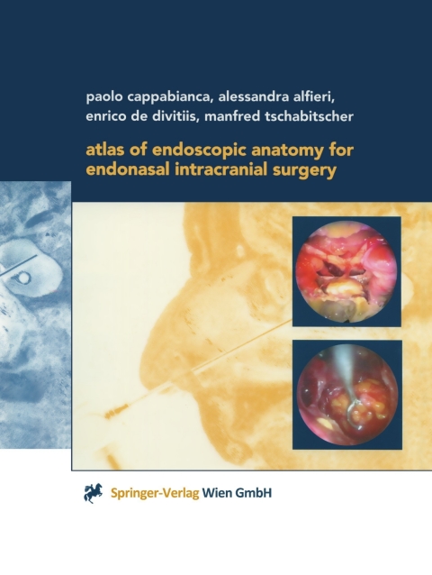 Cover image for book Atlas of Endoscopic Anatomy for Endonasal Intracranial Surgery
