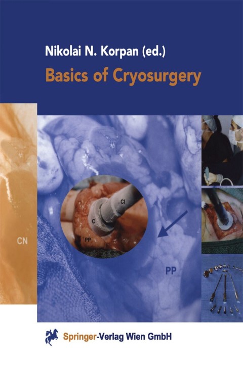Cover image for book Basics of Cryosurgery